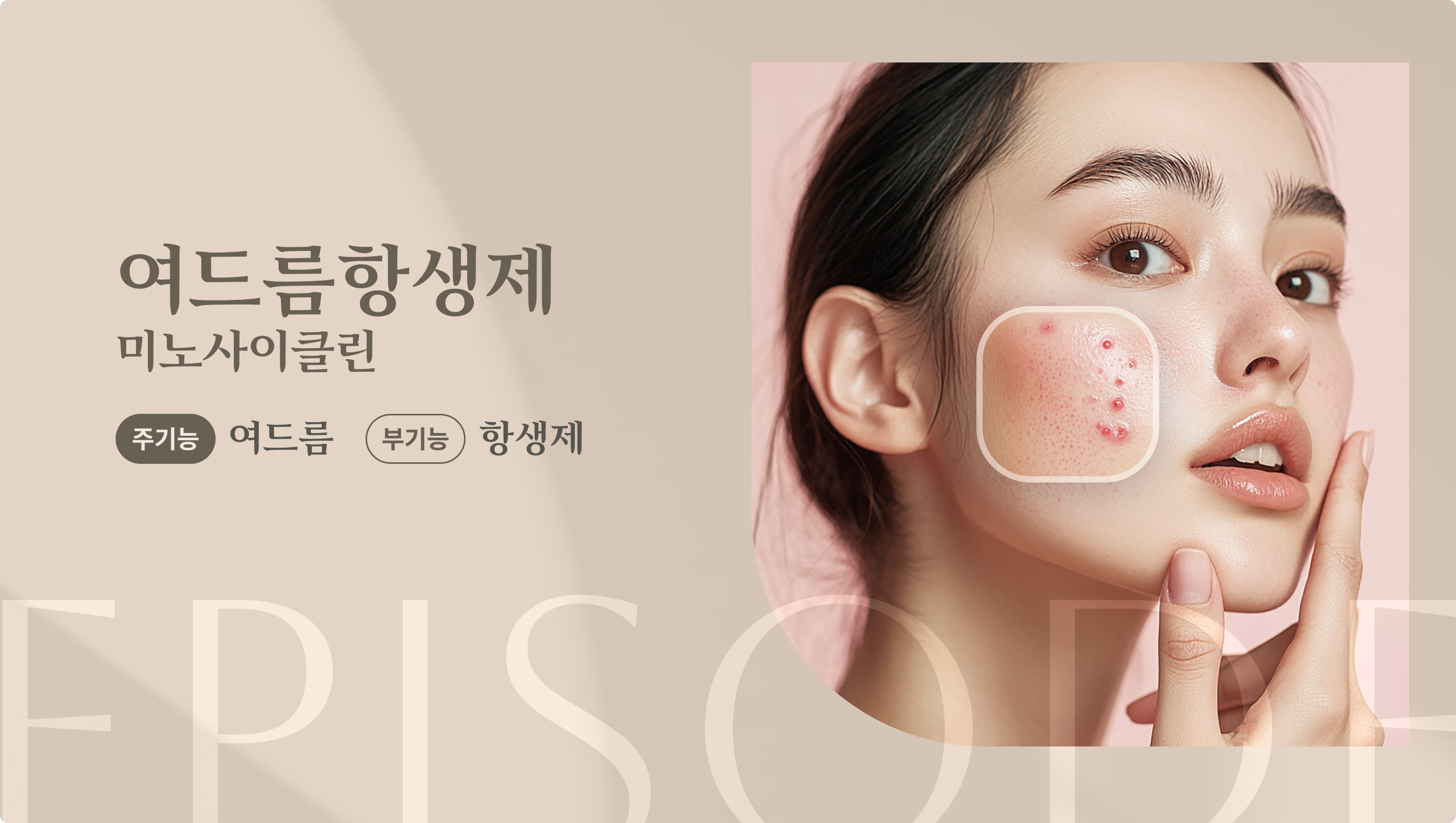 여드름항생제 안내 1