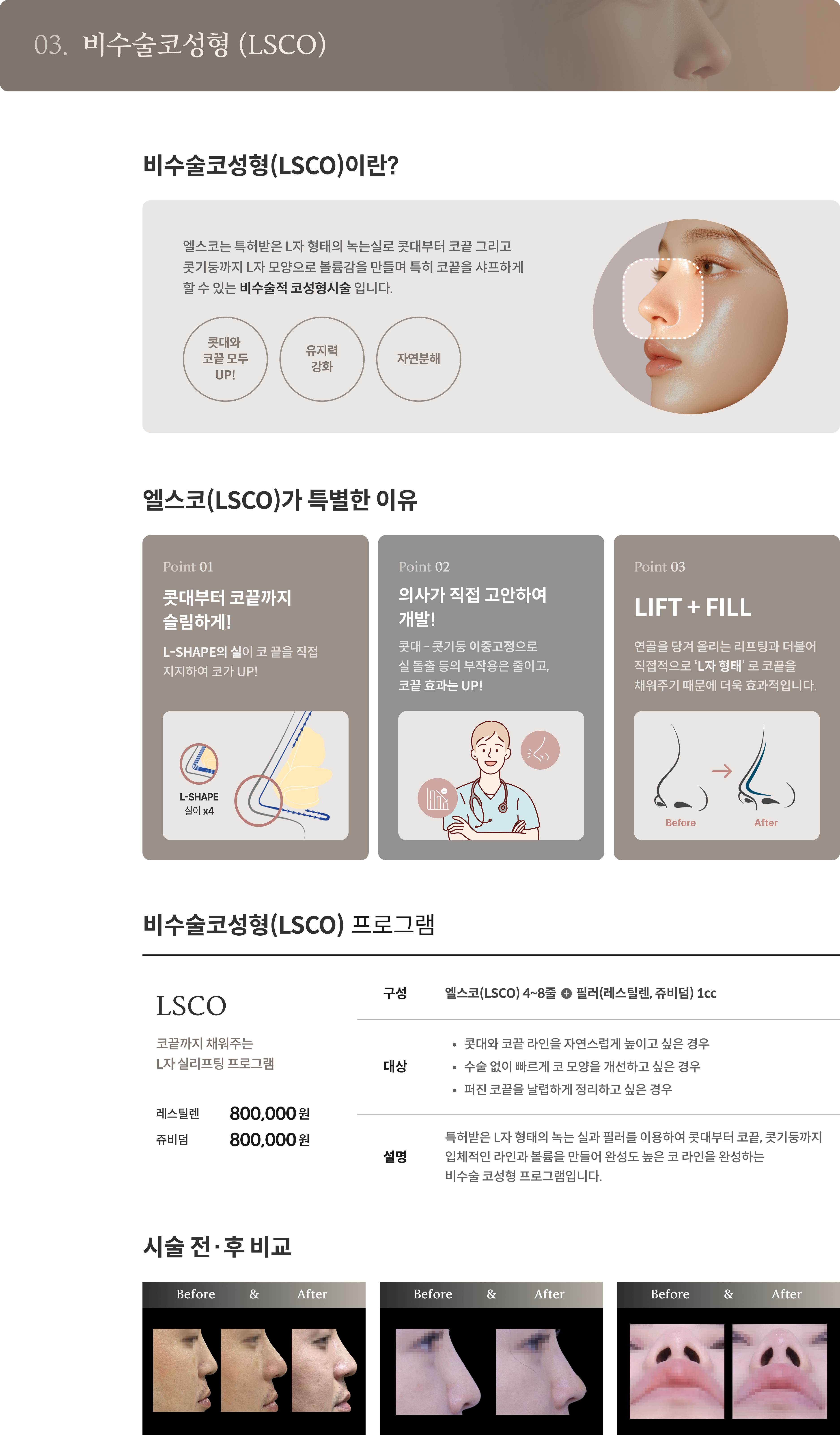 타임리버스 실리프팅 안내 4