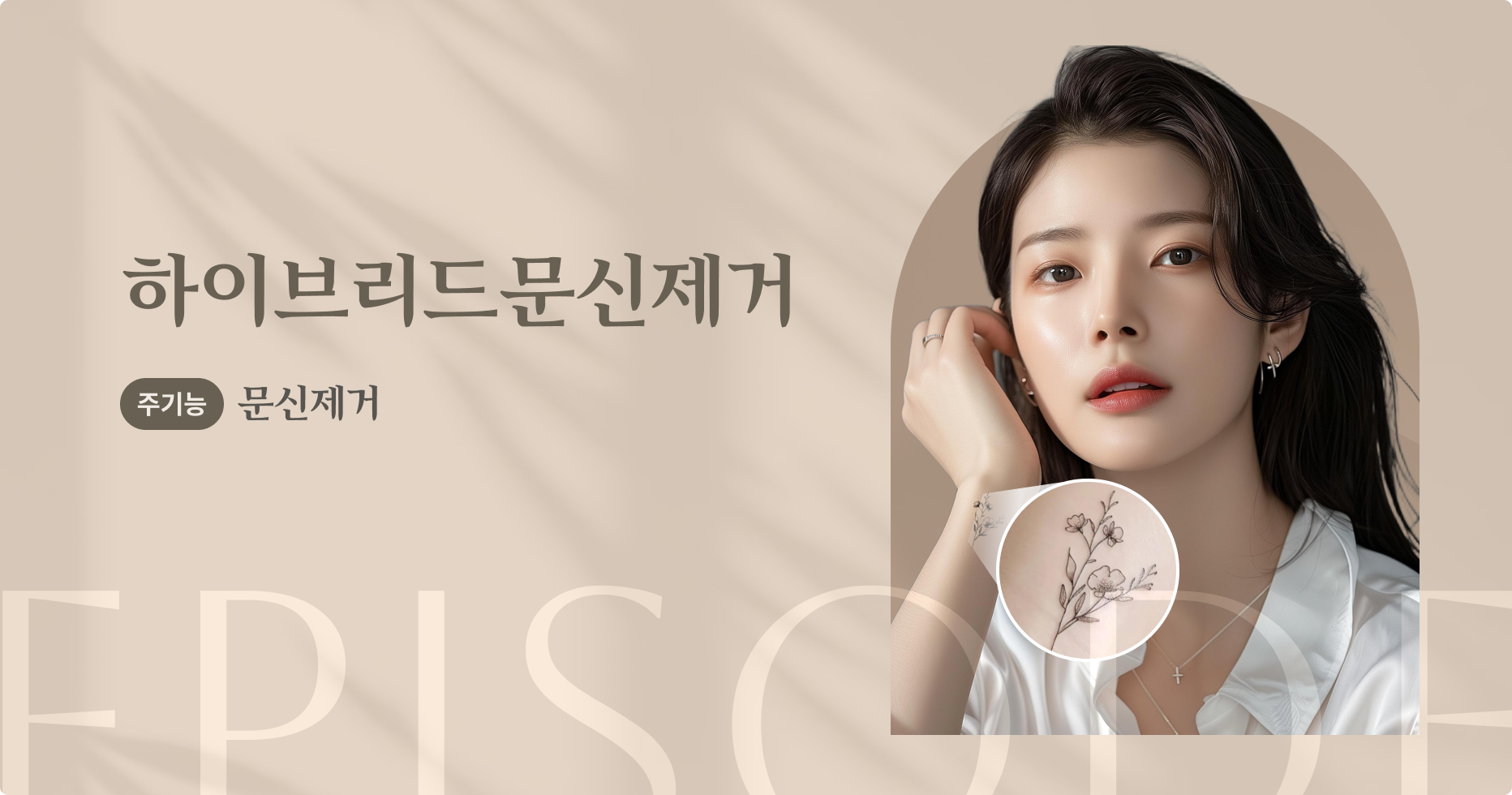 검은문신제거 안내 1