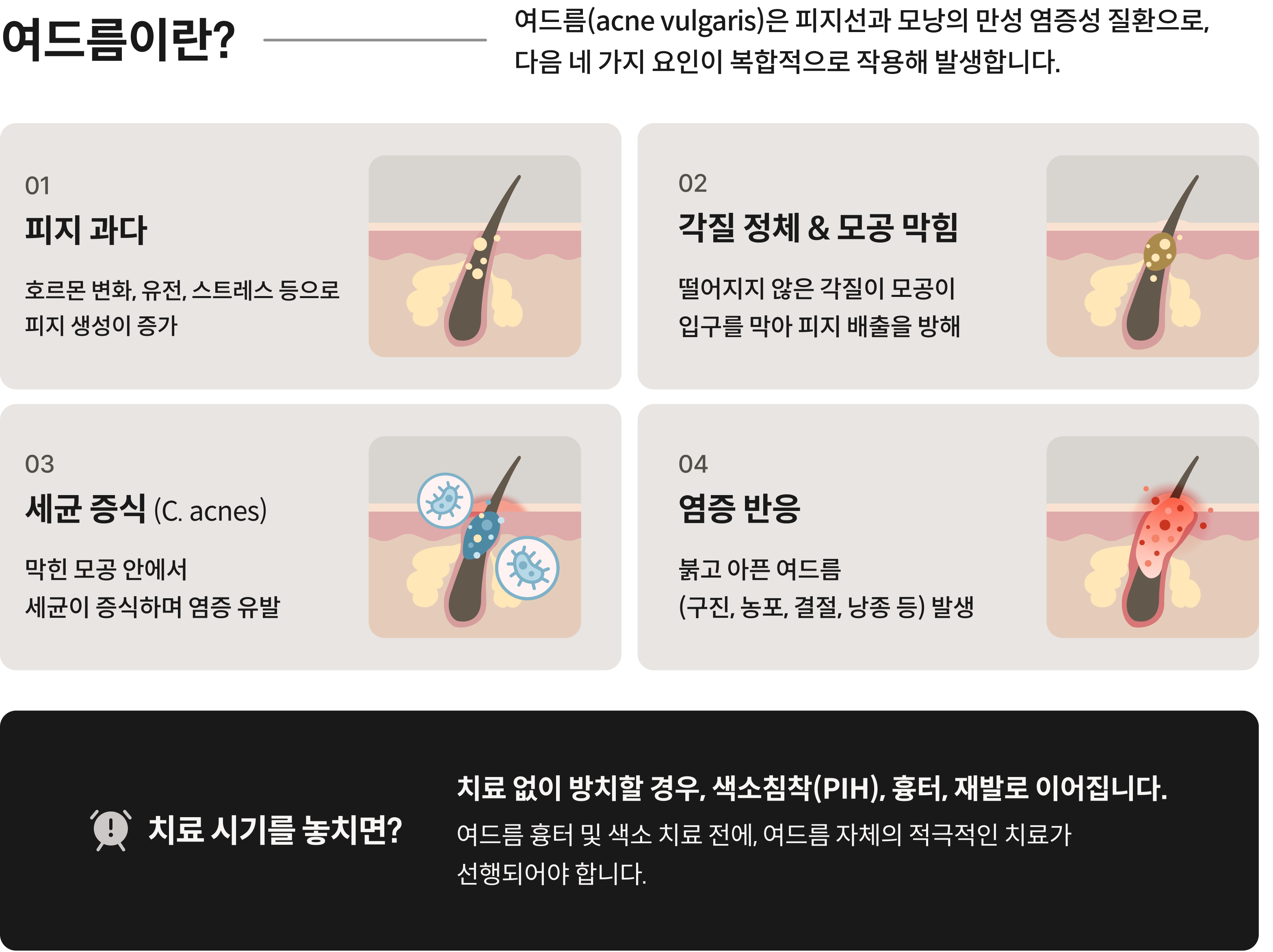 매번 다시 올라오는 여드름 트러블 여드름 치료는