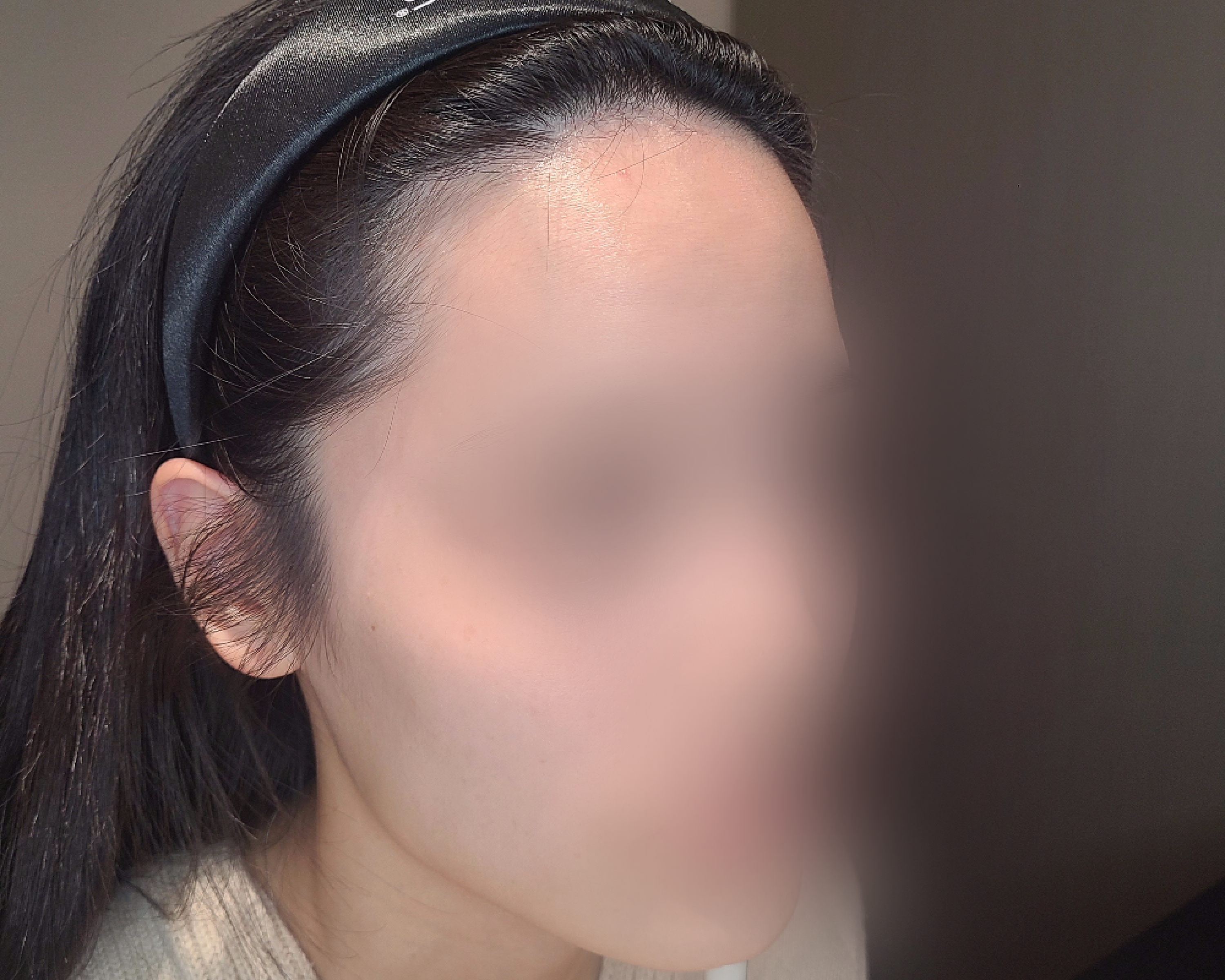 무너지고 처지는 얼굴라인 꺼진 얼굴 볼륨