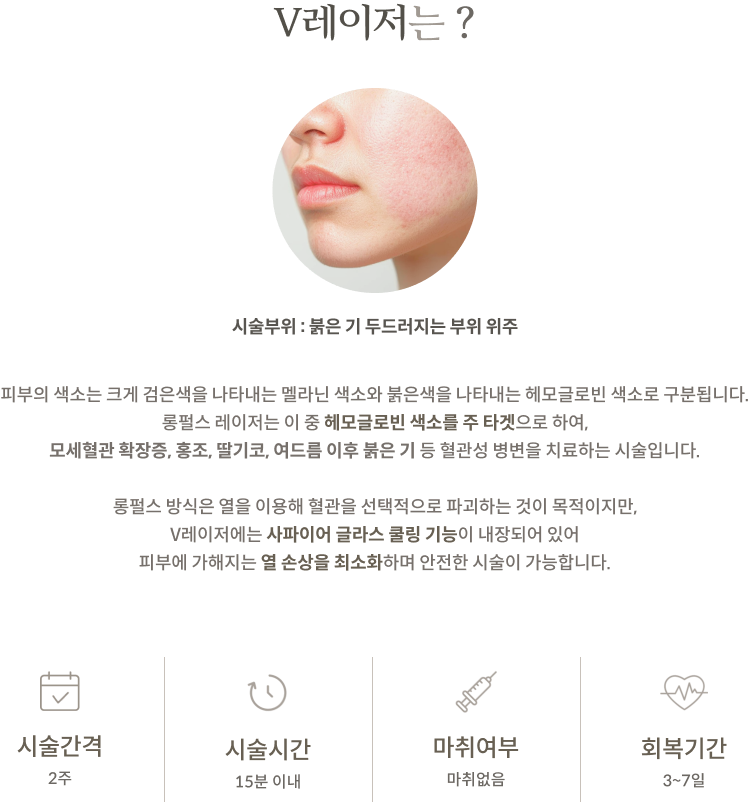 V레이저 안내 2