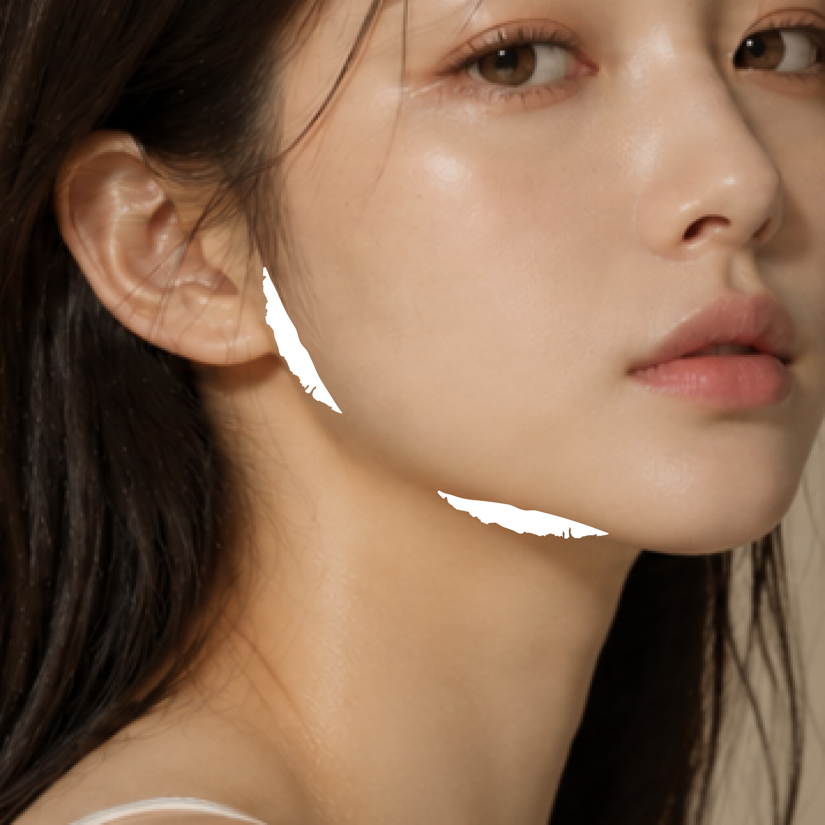 침샘보톡스