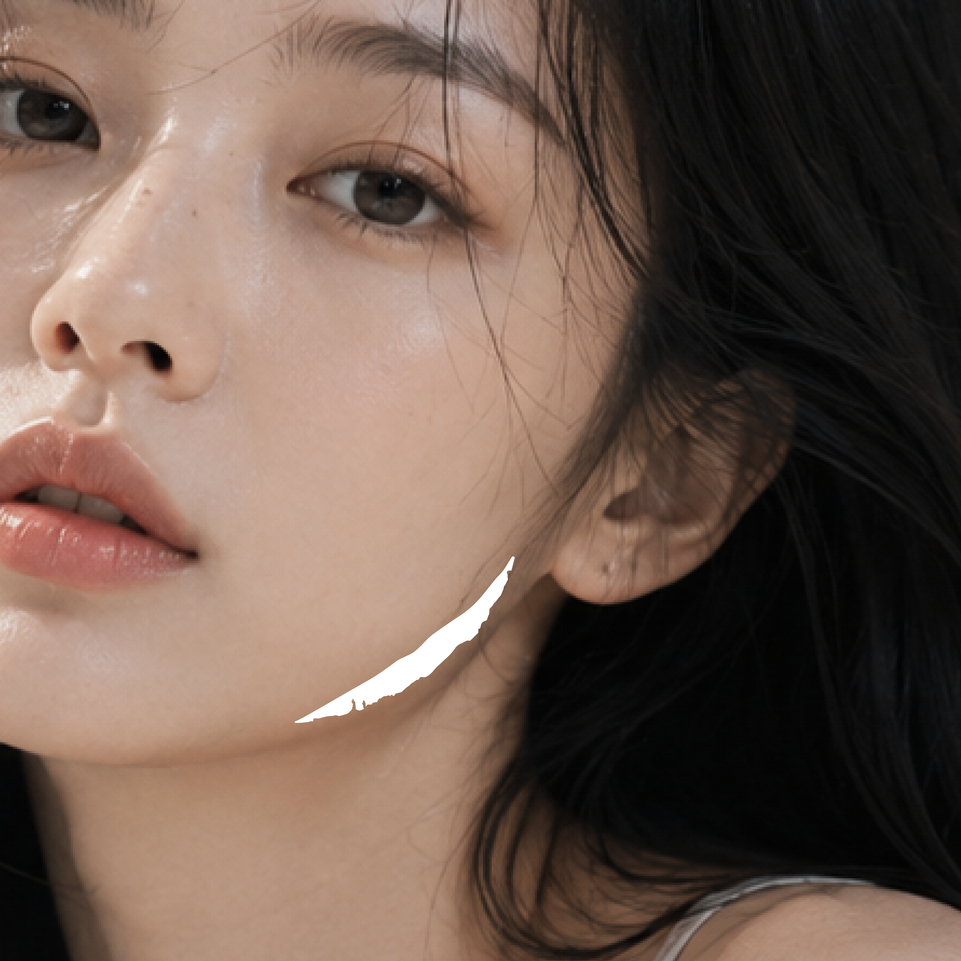 사각턱보톡스
